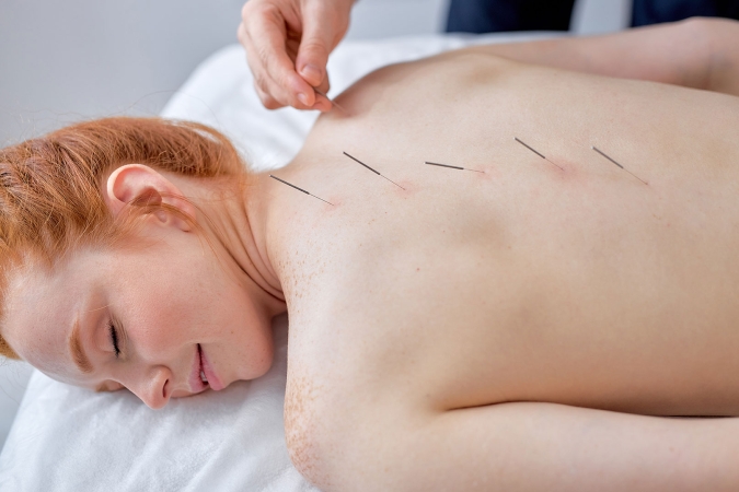 Epilazione Permanente Laser a Diodo 808nm